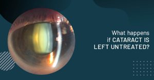 ophthalmologist Sydney