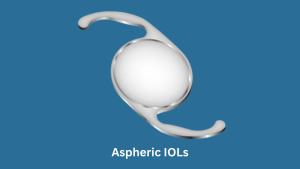 Best IOL Lens Options for Your Cataract Surgery Explained