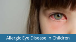 allergic eye disease in children
