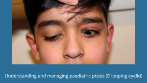 Understanding and managing paediatric ptosis (Drooping eyelid)