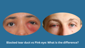 Blocked tear duct vs Pink eye: What is the difference?