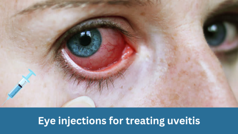 Eye Injections for Treating Uveitis: An Effective Approach