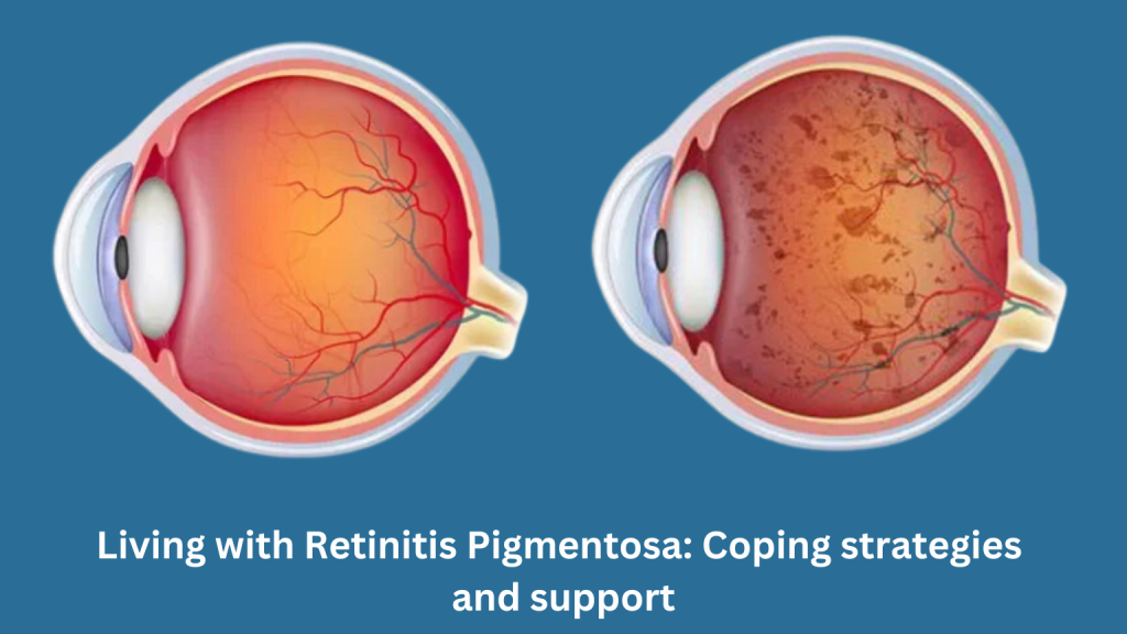 Living with Retinitis Pigmentosa: Coping strategies and support