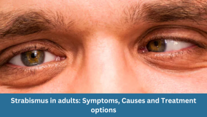 Strabismus in adults: Symptoms, Causes and Treatment options