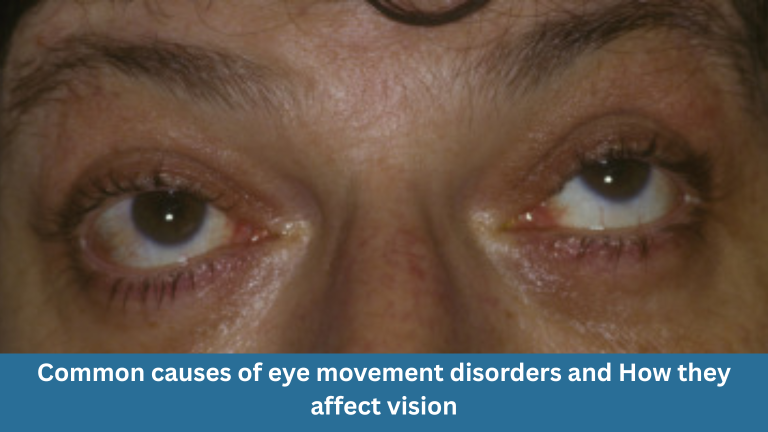 Shaky Vision Common Eye Movement Disorders & Their Impact on Vision