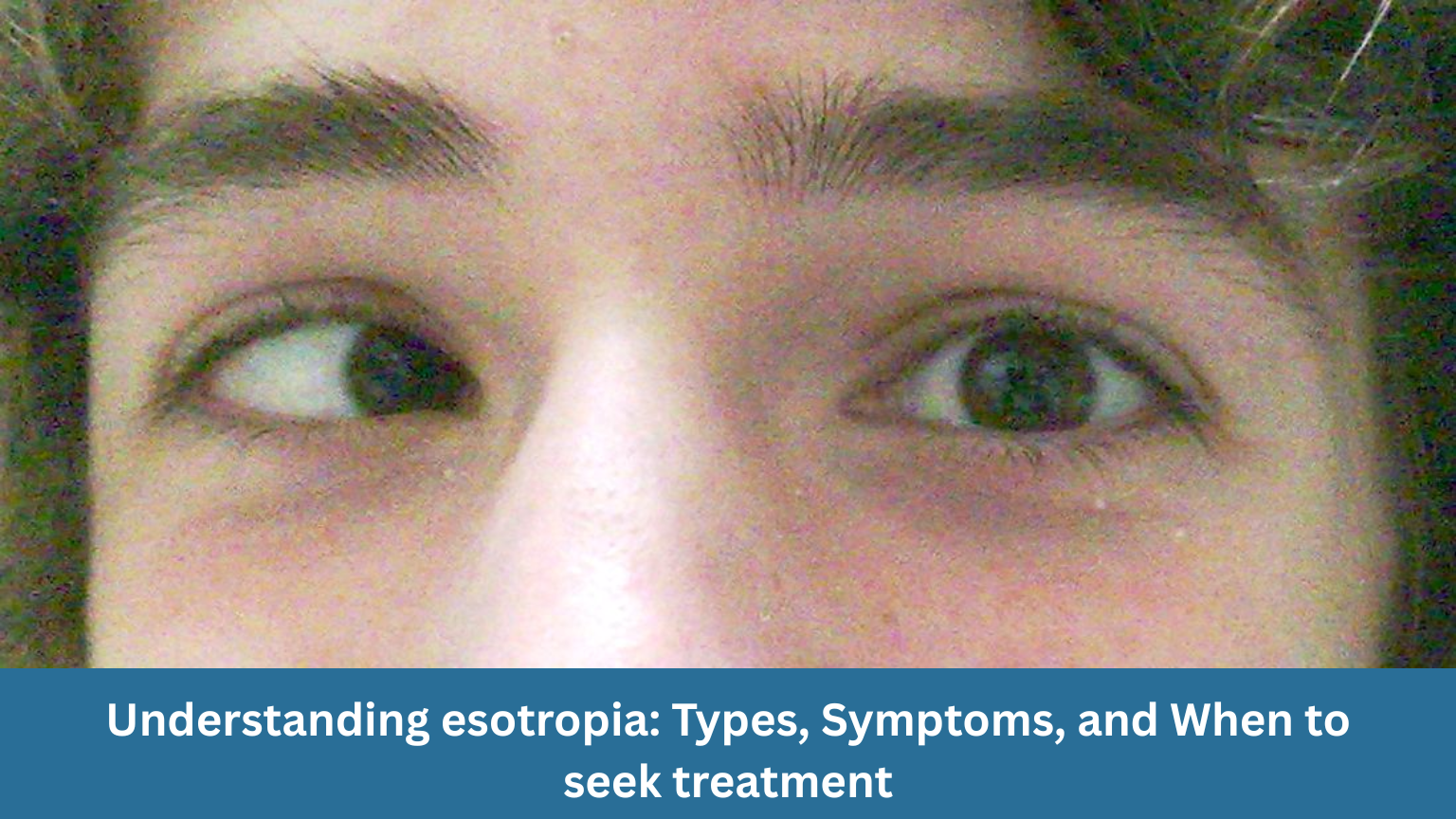 Understanding esotropia: types, symptoms, and when to seek treatment