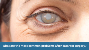 What are the most common problems after cataract surgery?