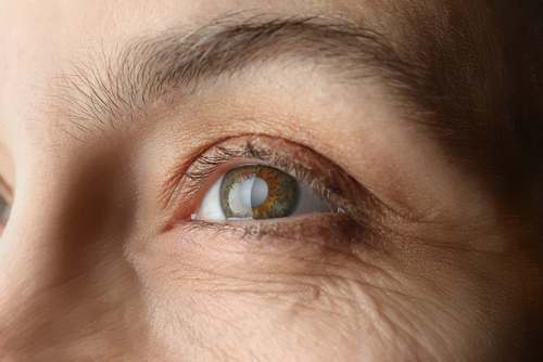 Light sensitivity and glare