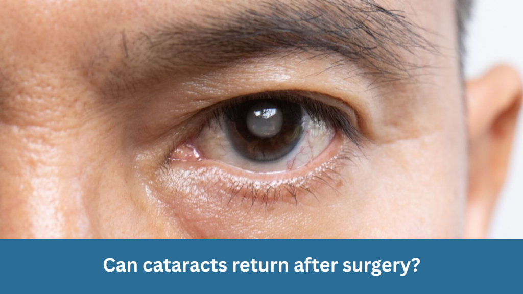 Can cataracts return after surgery?