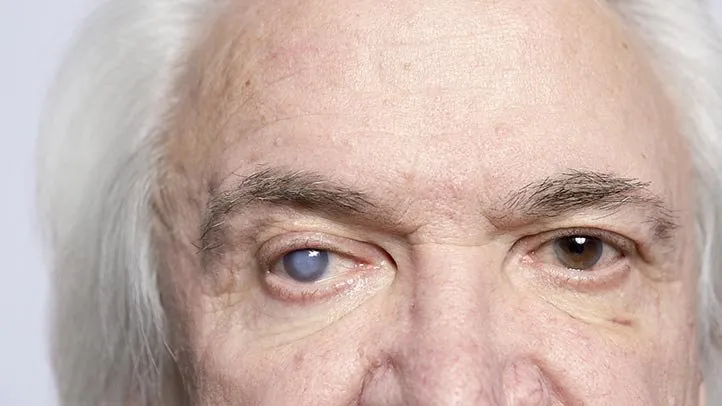 5. Why does vision in one eye feel worse than the other?
