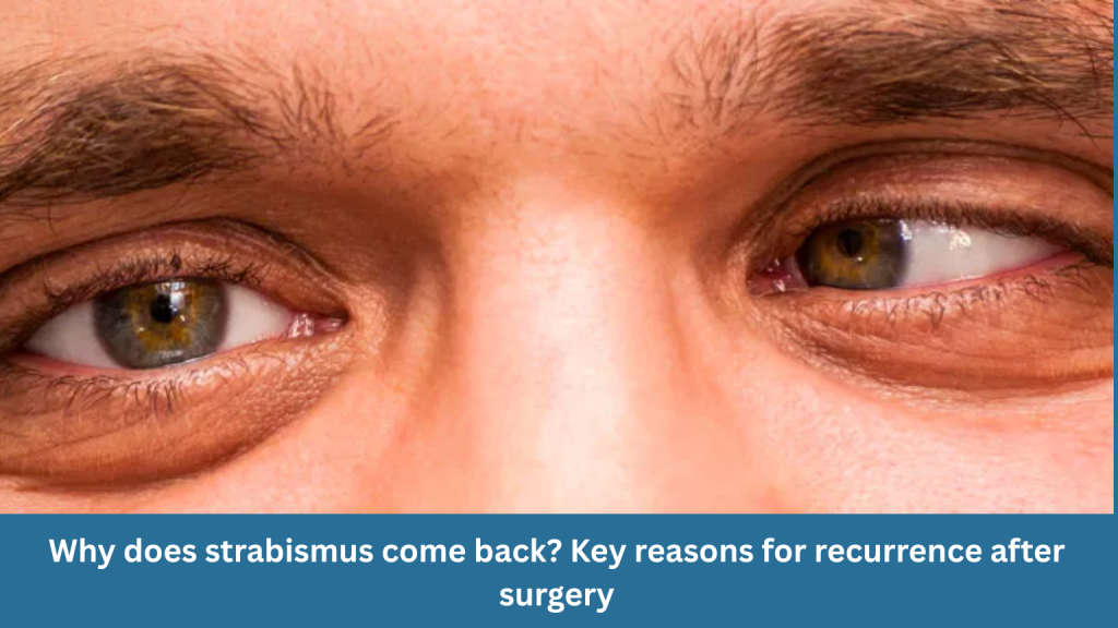 Why does strabismus come back? Key reasons for recurrence after surgery