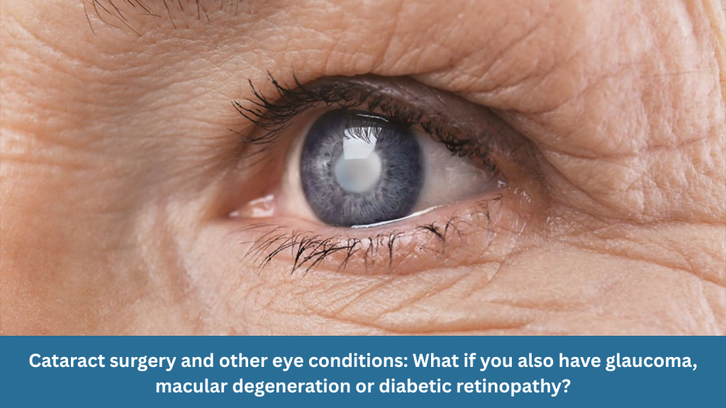 Cataract surgery and other eye conditions: What if you also have glaucoma, macular degeneration or diabetic retinopathy?