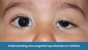 Understanding rare congenital eye disorders in children