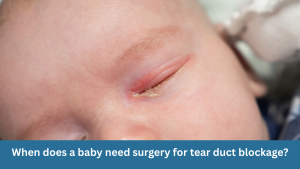 When does a baby need surgery for tear duct blockage?