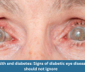 Eye health and diabetes: Signs of diabetic eye disease you should not ignore